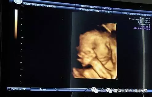 微信截图_20170316094945.png