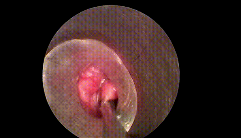 202201071546 (1).gif