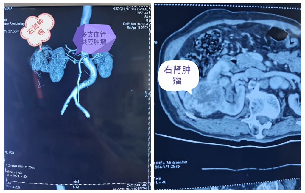 光影魔术手拼图.jpg