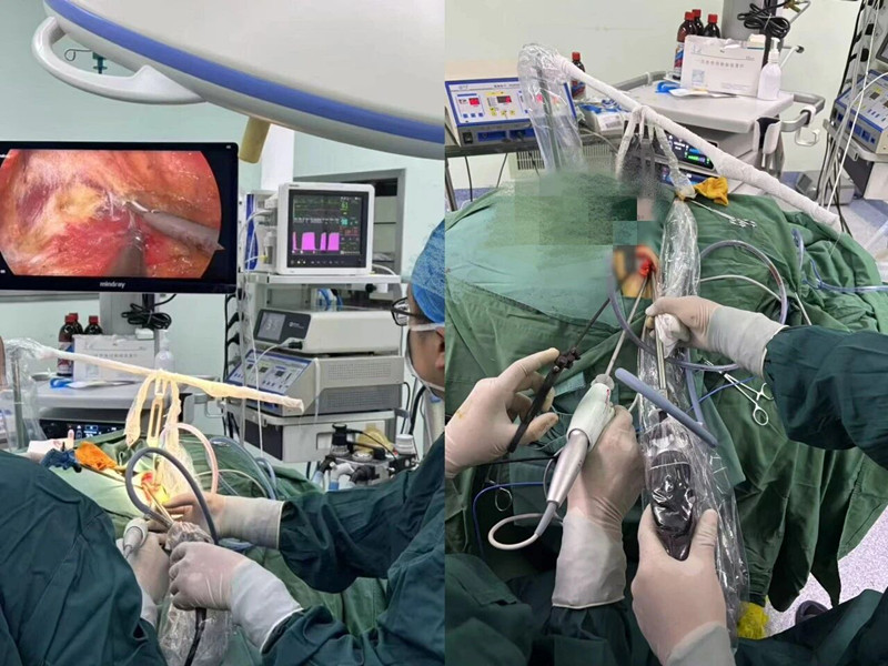 手术1_副本.jpg